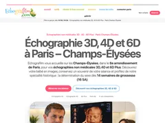 Echografilm